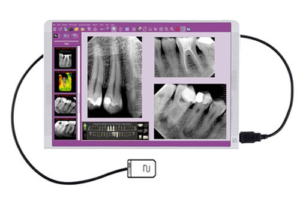 MyRay Zen X real-time-image